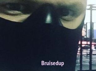 Bruisedup