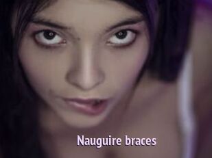 Nauguire_braces